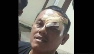Kronologi Penganiayaan 2 Wartawan di Karawang Versi Korban
